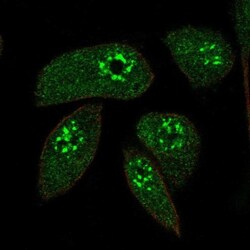 Map17 Antibody, Novus Biologicals 25 &mu;L; Unlabeled:Antibodies, Polyclonal
